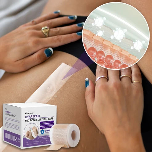 Alcuras® Microneedle Skin Tape