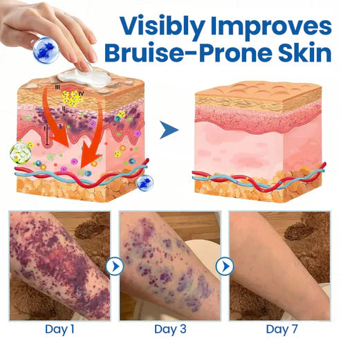 💥Alcuras® Fragile Skin Repair Cream🛡️ Multi-Repair for Bruises, Dryness & Spots