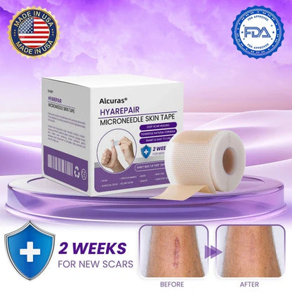 Alcuras® Microneedle Skin Tape