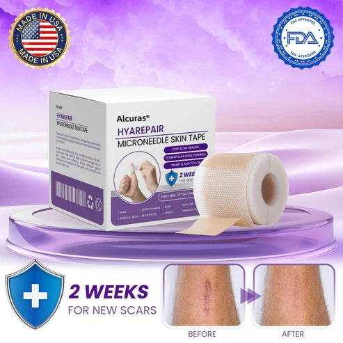 Alcuras® Microneedle Skin Tape