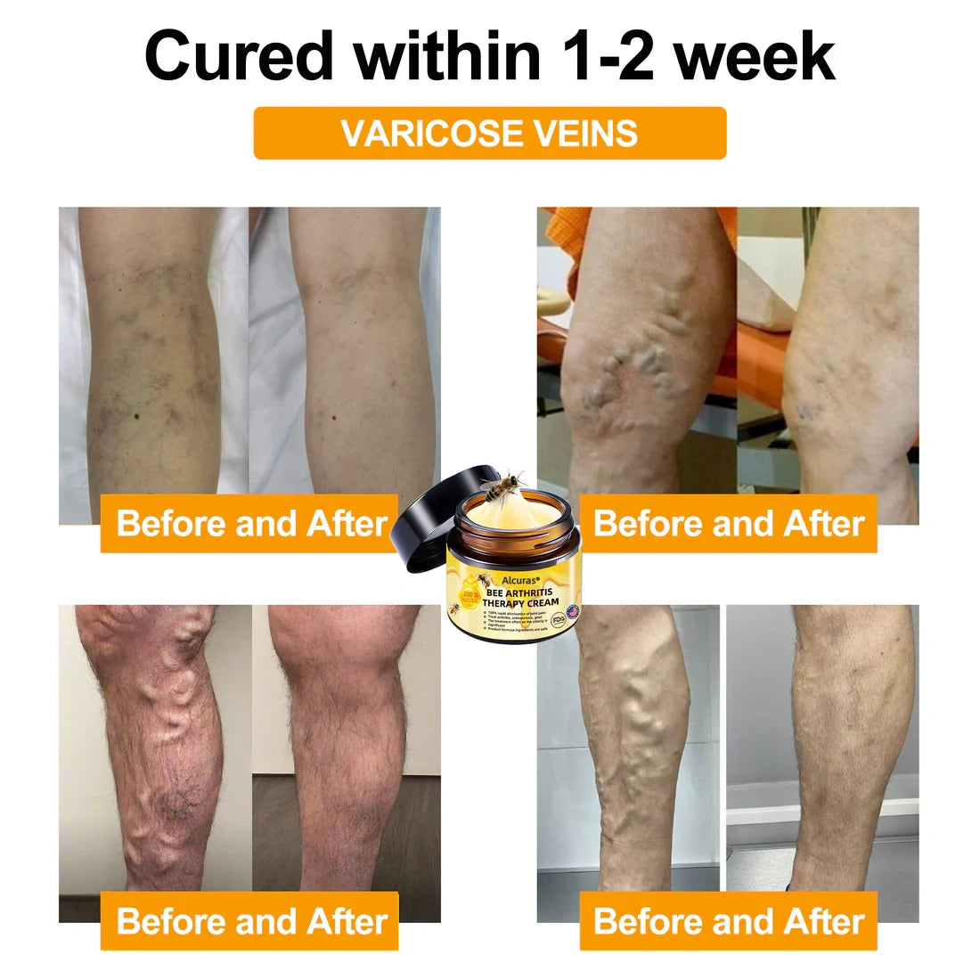 Alcuras™ AdvancedJoint and BoneTherapy Cream🐝