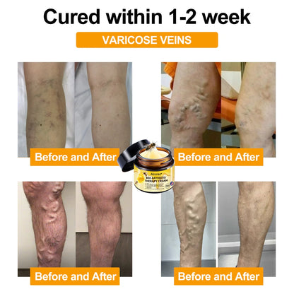 Alcuras™ AdvancedJoint and BoneTherapy Cream🐝