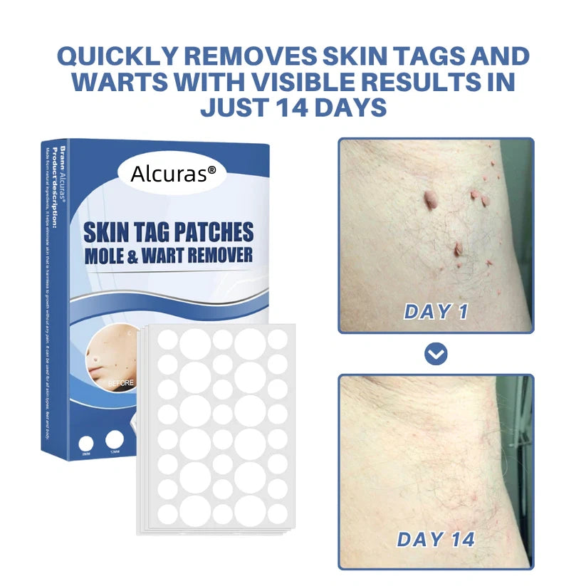 Alcuras® Moles & Warts Removing Skin Tag Patch