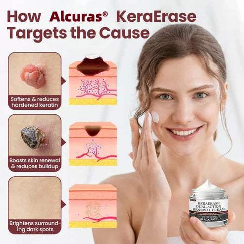 💥Alcuras® KeraErase Dual-Action Renewal Cream