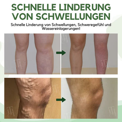 Alcuras™ Next-Gen Lymph Drainage and Vein Repair Cream