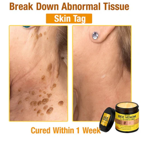 Alcuras™ Bee Poison All-in-One Cream Dermatologist Approved