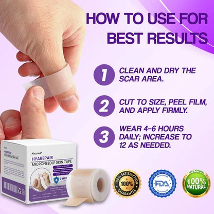 Alcuras® Microneedle Skin Tape