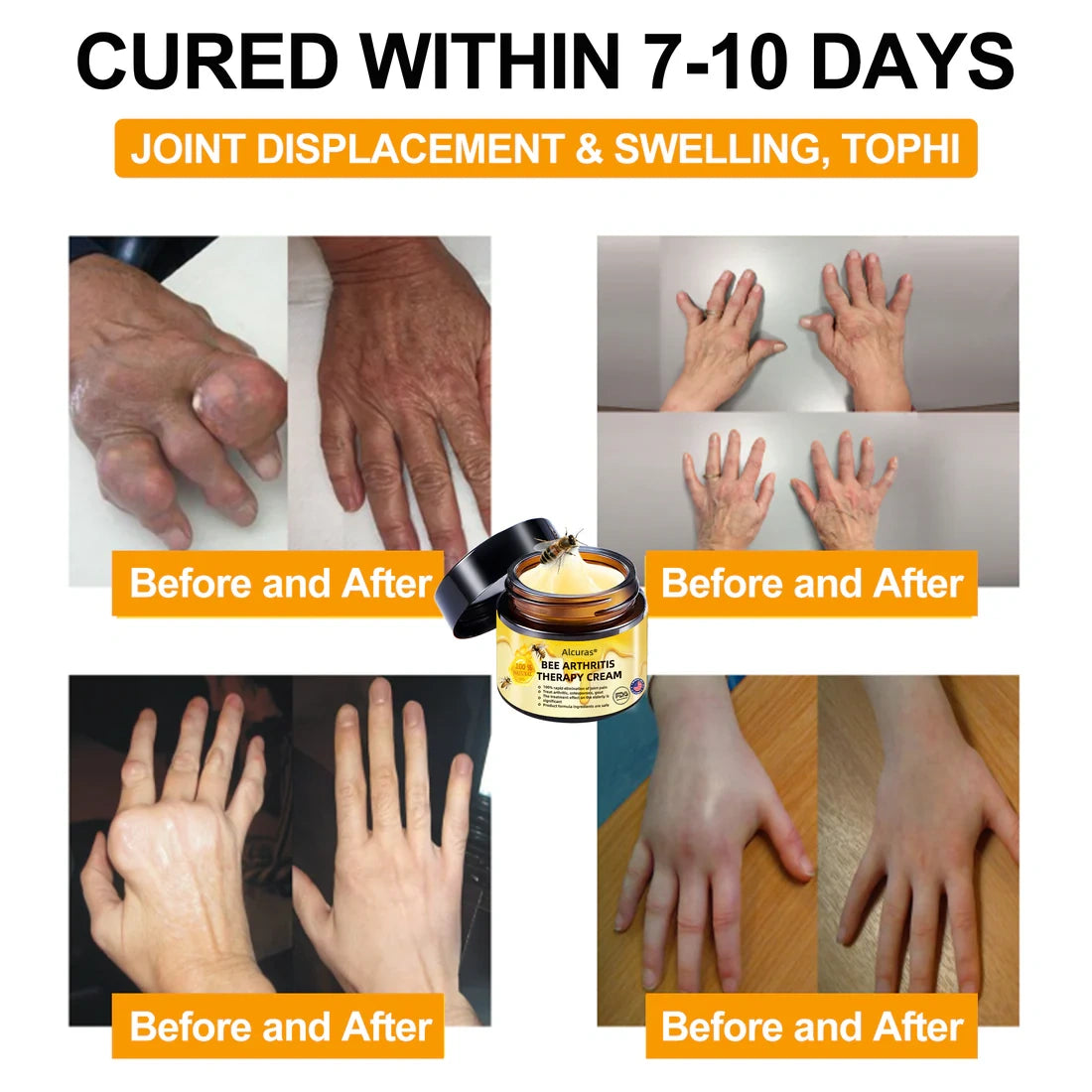 Alcuras™ AdvancedJoint and BoneTherapy Cream🐝