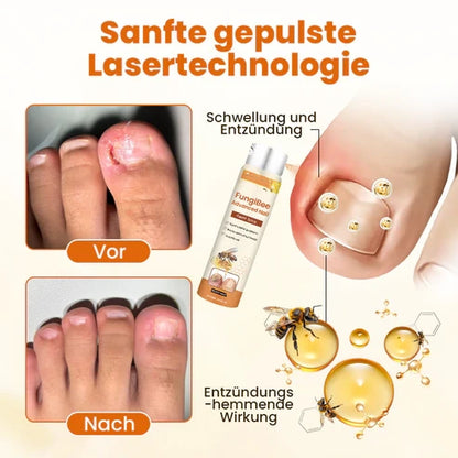 Alcuras® FungiBee Advanced Nail Repair Spray