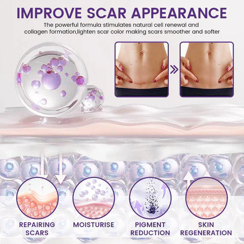 💥Alcuras® ReGenScar Stem Cell Scar Gel