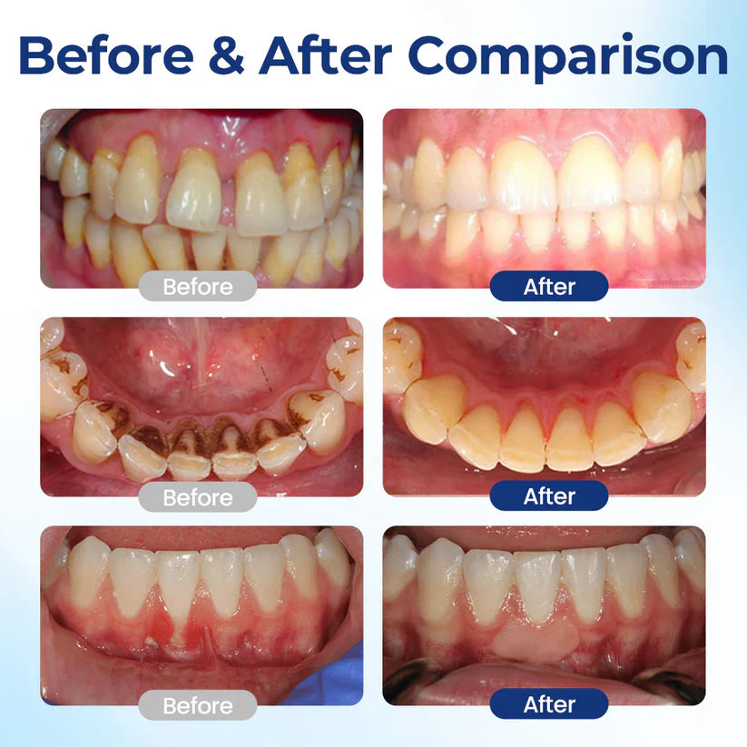 Alcuras® BeeTakt Oral Repair Solution