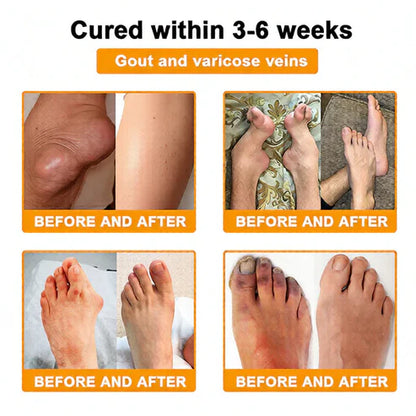 🏆50K+ SOLD LAST WEEK! 🌿Alcuras® Bee Poison Pain-Relief Bone Healing Cream