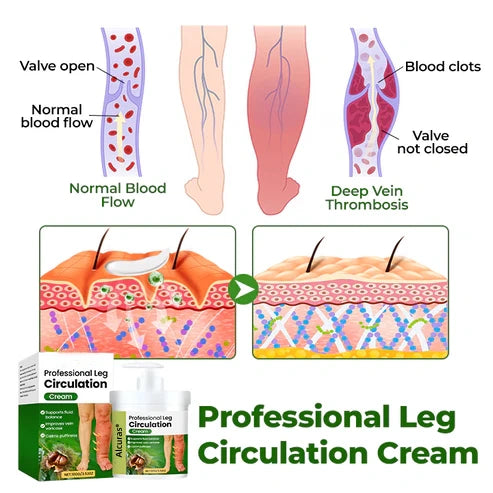 Alcuras® Professional Leg Circulation Cream