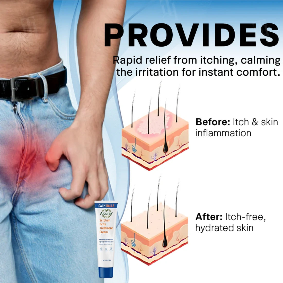 Alcuras® Scrotum Itchy Treatment Cream
