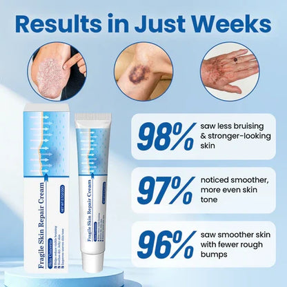 💥Alcuras® Fragile Skin Repair Cream🛡️ Multi-Repair for Bruises, Dryness & Spots