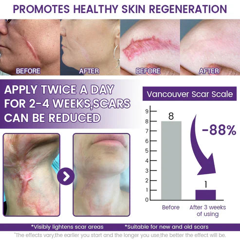 💥Alcuras® ReGenScar Stem Cell Scar Gel