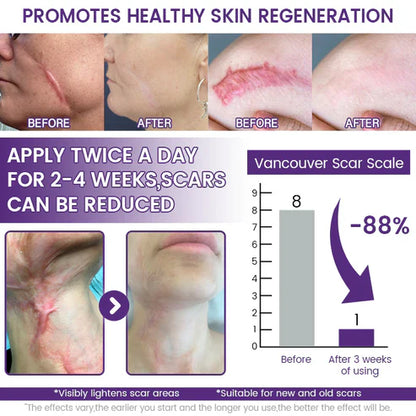 💥Alcuras® ReGenScar Stem Cell Scar Gel