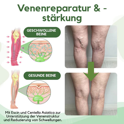Alcuras™ Next-Gen Lymph Drainage and Vein Repair Cream