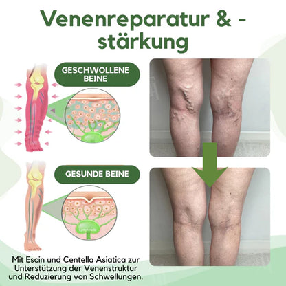 Alcuras™ Next-Gen Lymph Drainage and Vein Repair Cream