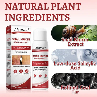 Alcuras® Snail Mucin Healing Spray – Relief for Sensitive & Flare-Up Skin