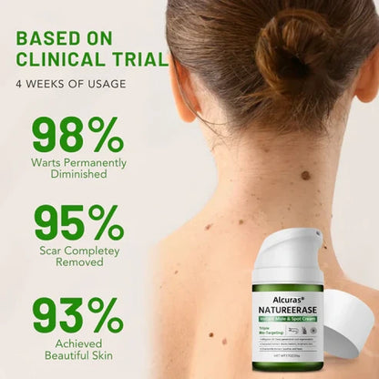 ✅ Official Store: Alcuras® NatureErase Instant Mole & Spot Cream