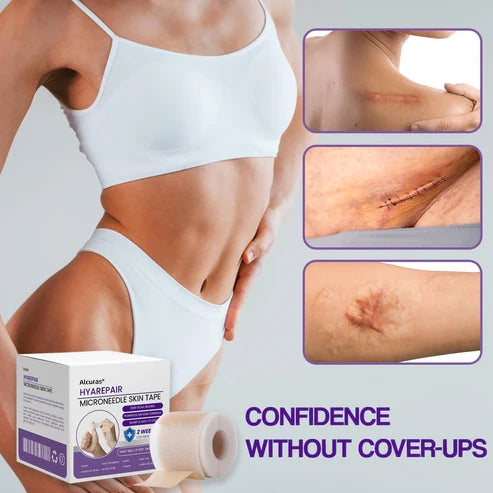 Alcuras® Microneedle Skin Tape