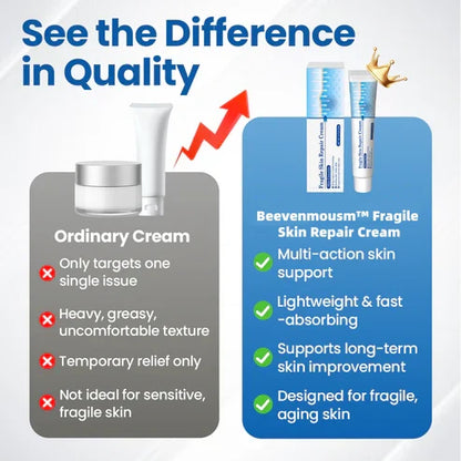 💥Alcuras® Fragile Skin Repair Cream🛡️ Multi-Repair for Bruises, Dryness & Spots