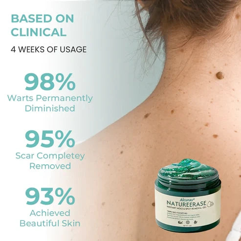 ✅ Official Store: Alcuras® NatureErase Instant Mole & Spot Removal Gel