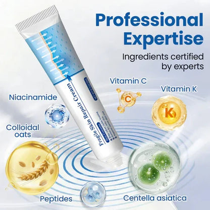 💥Alcuras® Fragile Skin Repair Cream🛡️ Multi-Repair for Bruises, Dryness & Spots