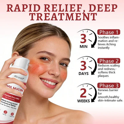 Alcuras® Snail Mucin Healing Spray – Relief for Sensitive & Flare-Up Skin