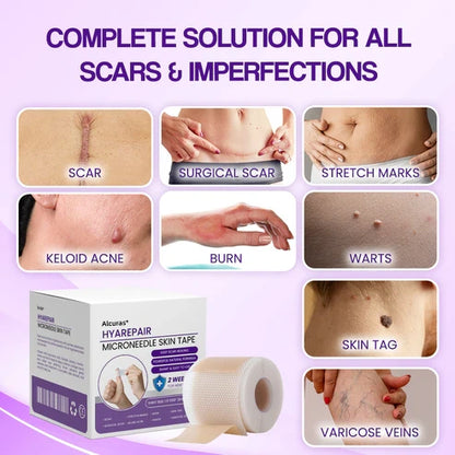 Alcuras® Microneedle Skin Tape