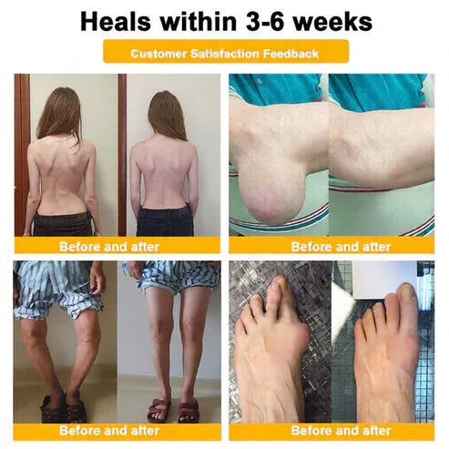🏆50K+ SOLD LAST WEEK! 🌿Alcuras® Bee Poison Pain-Relief Bone Healing Cream