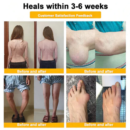 🏆50K+ SOLD LAST WEEK! 🌿Alcuras® Bee Poison Pain-Relief Bone Healing Cream