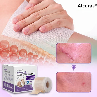 Alcuras® Microneedle Skin Tape